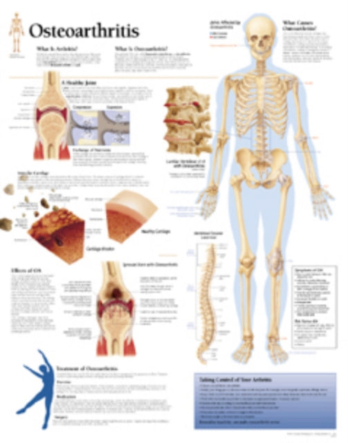 Book cover of: Osteoarthritis Paper Poster