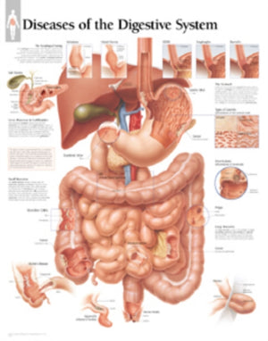 Diseases of the Digestive System Paper Poster
