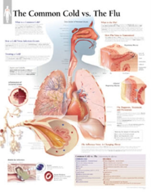 Book cover of: Common Cold vs the Flu Laminated Poster. By: Scientific Publishing