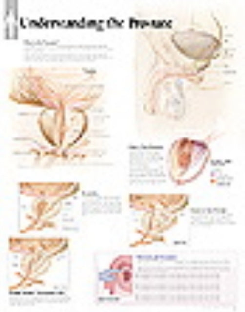 Book cover of: Understanding the Prostate Laminated Poster. By: Scientific Publishing