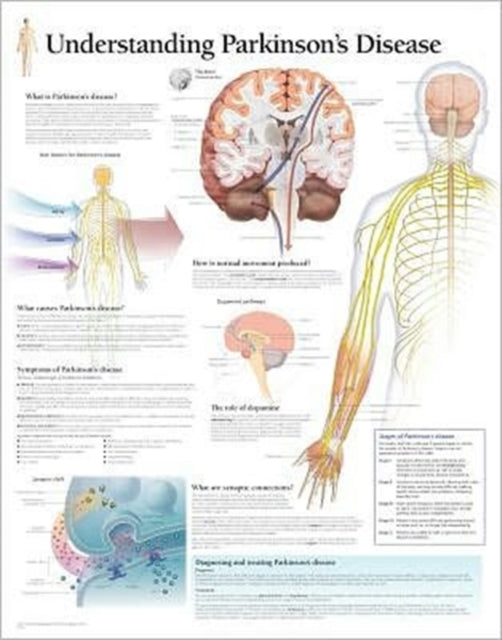 Book cover of: Understanding Parkinson's Paper Poster. By: Scientific Publishing