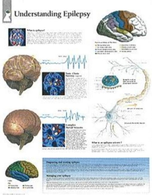 Book cover of: Understanding Epilepsy Paper Poster. By: Scientific Publishing