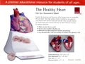Healthy Heart