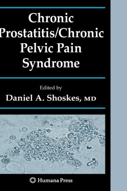 Book cover of: Chronic Prostatitis/Chronic Pelvic Pain Syndrome