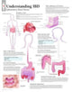 Book cover of: Understanding IBD