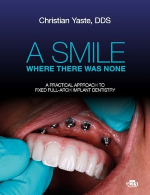 Book cover of: Smile Where There Was None