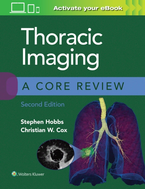Book cover of: Thoracic Imaging: A Core Review. By: Stephen Hobbs MD