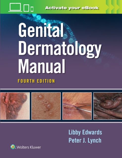 Book cover of: Genital Dermatology  Manual. By: Elizabeth Edwards