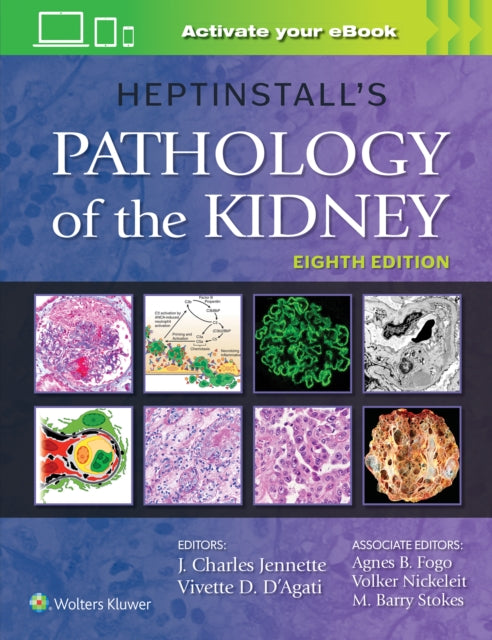 Book cover of: Heptinstall's Pathology of the Kidney. By: J. Charles Jennette