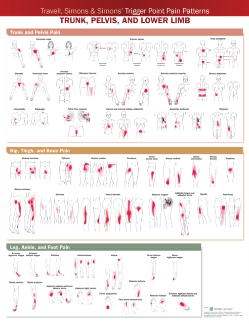 Book cover of: Travell, Simons & Simons’ Trigger Point Pain Patterns Wall Chart