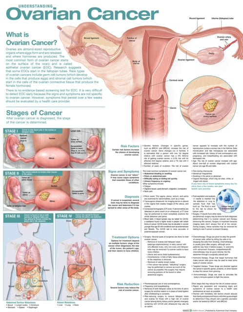 Book cover of: Understanding Ovarian Cancer Anatomical Chart