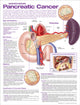 Book cover of: Understanding Pancreatic Cancer Anatomical Chart