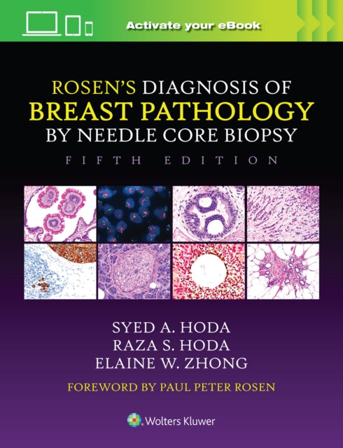 Book cover of: Rosen's Diagnosis of Breast Pathology by Needle Core Biopsy. By: Syed A. Hoda
