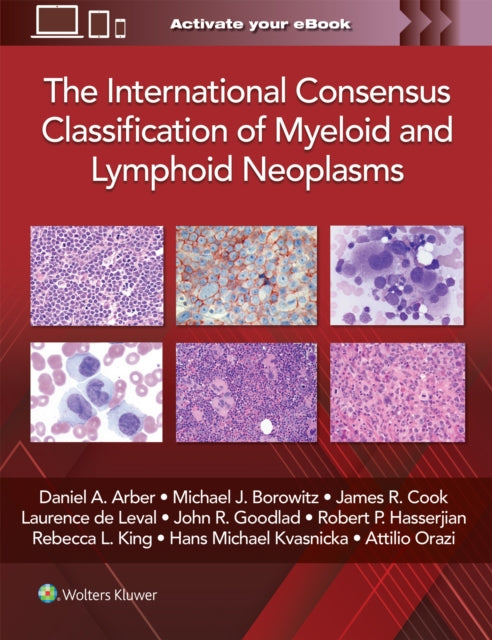 Book cover of: International Consensus Classification of Myeloid and Lymphoid Neoplasms. By: Daniel A. ARBER