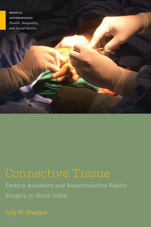 Connective Tissue