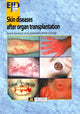 Book cover of: Skin Diseases After Organ Transplantation