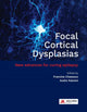 Book cover of: Focal Cortical Dysplasias. By: Francine Chassoux