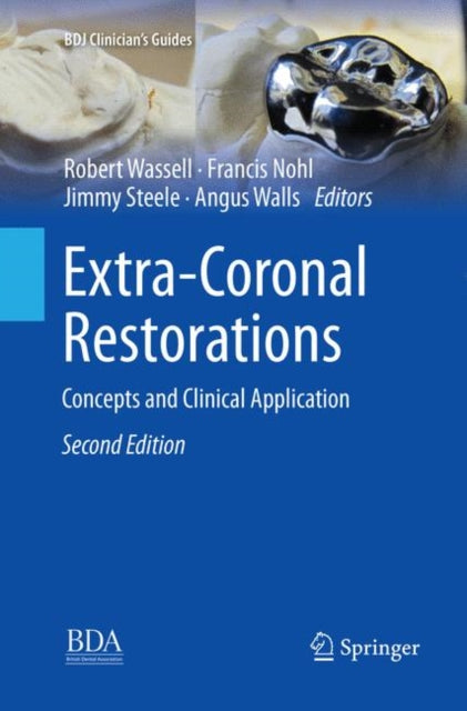 Book cover of: Extra-Coronal Restorations. By: Robert Wassell