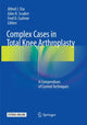 Book cover of: Complex Cases in Total Knee Arthroplasty. By: Alfred J. Tria