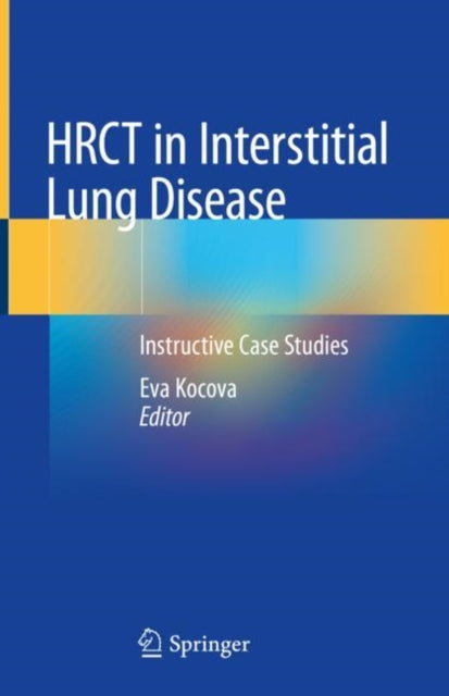 Book cover of: HRCT in Interstitial Lung Disease. By: Eva Kocova