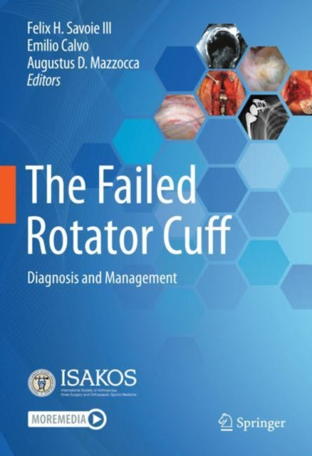 Book cover of: Failed Rotator Cuff. By: Felix H. Savoie III