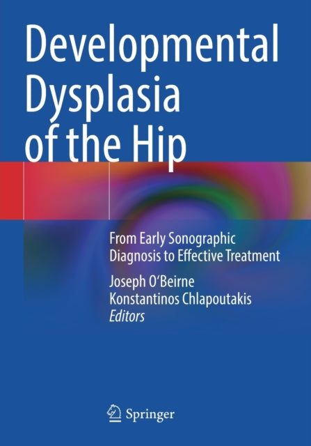 Book cover of: Developmental Dysplasia of the Hip. By: Joseph O'Beirne