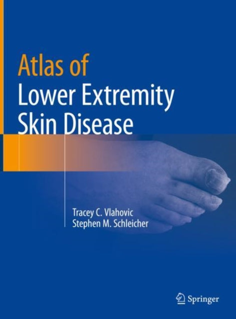 Book cover of: Atlas of Lower Extremity Skin Disease. By: Tracey C. Vlahovic
