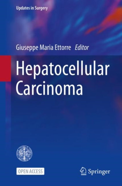 Book cover of: Hepatocellular Carcinoma. By: Giuseppe Maria Ettorre