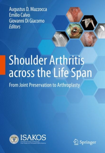 Book cover of: Shoulder Arthritis across the Life Span. By: Emilio Calvo