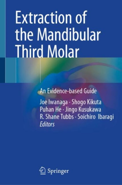 Book cover of: Extraction of the Mandibular Third Molar. By: Joe Iwanaga