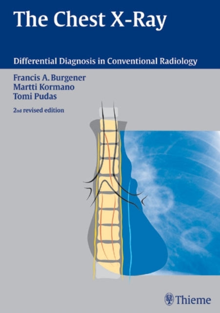 Book cover of: Chest X-Ray. By: Francis A. Burgener