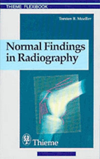 Book cover of: Normal Findings in Radiography. By: Torsten B. Moller