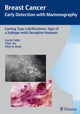 Book cover of: Casting-Type Calcifications: Sign of a Subtype with Deceptive Features. By: László Tabár, Laszlo Tabar