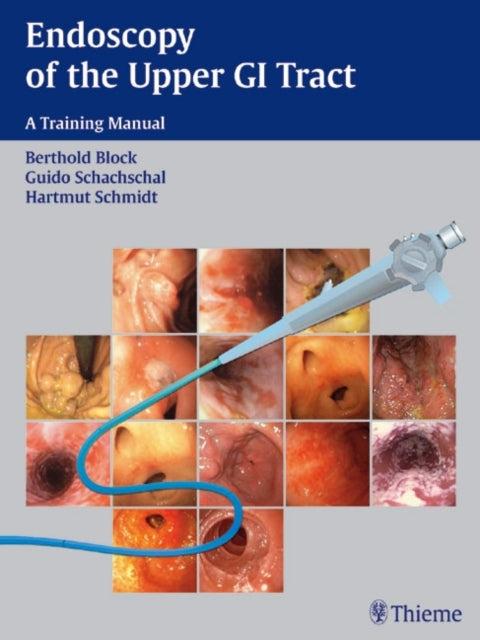 Book cover of: Endoscopy of the Upper GI Tract