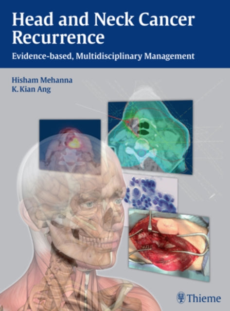 Book cover of: Head and Neck Cancer Recurrence. By: Hisham M. Mehanna