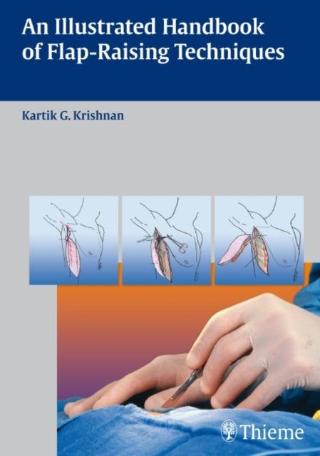 Book cover of: Illustrated Handbook of Flap-Raising Techniques. By: Kartik G. Krishnan