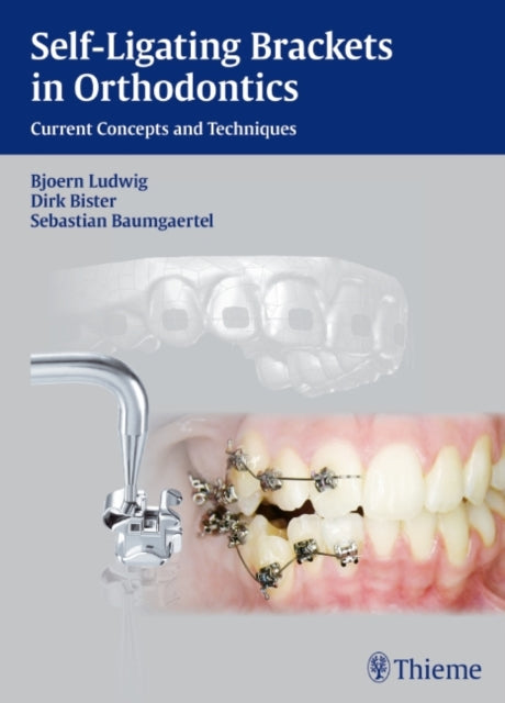 Book cover of: Self-ligating Brackets in Orthodontics. By: Björn Ludwig