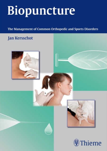 Book cover of: Biopuncture. By: Jan Kersschot
