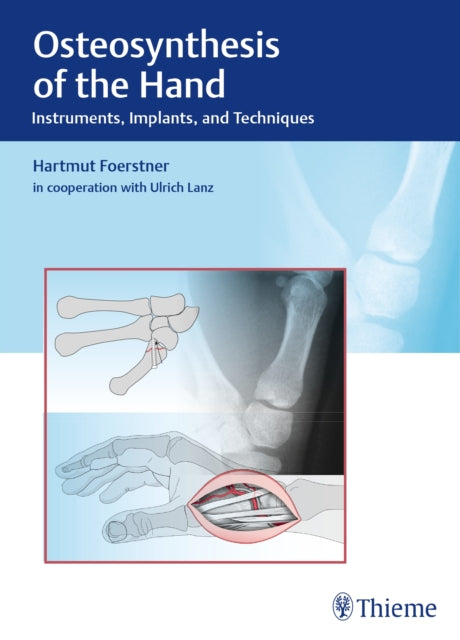 Book cover of: Osteosynthesis of the Hand. By: Hartmut Förstner