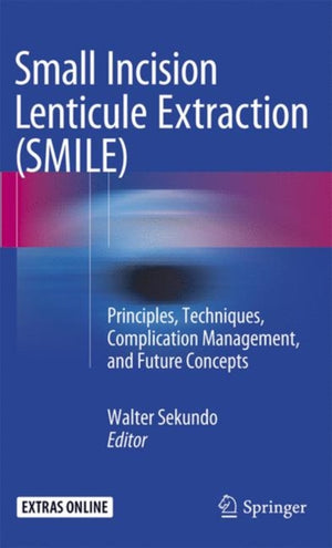 Small Incision Lenticule Extraction (SMILE)