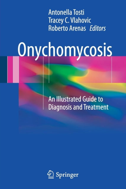 Book cover of: Onychomycosis. By: Antonella Tosti