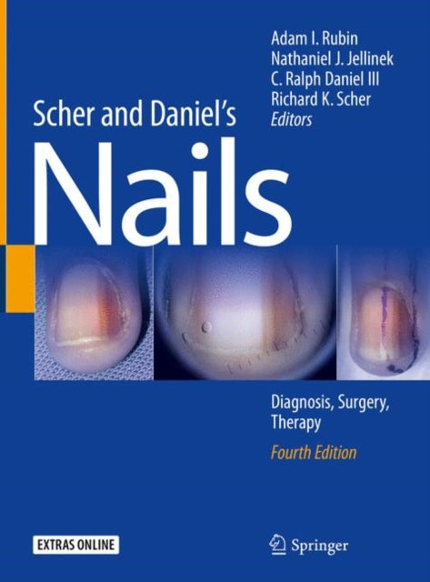 Book cover of: Scher and Daniel's Nails. By: Adam I. Rubin