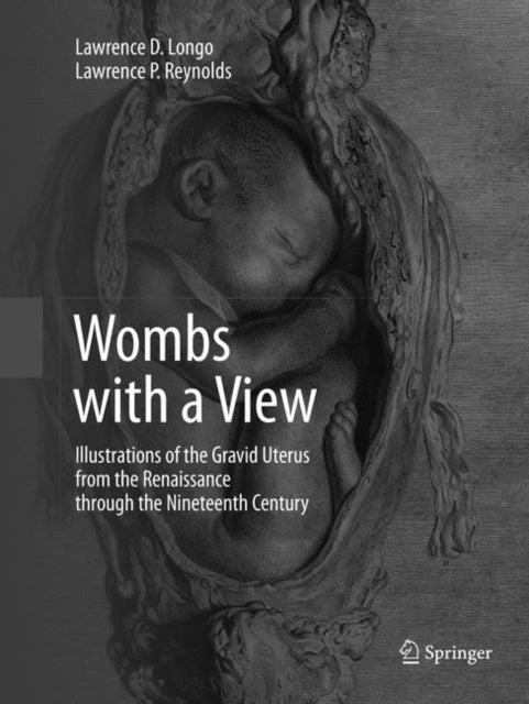 Book cover of: Wombs with a View. By: Lawrence D. Longo