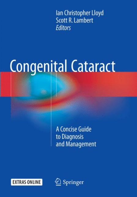 Book cover of: Congenital Cataract. By: Ian Christopher Lloyd