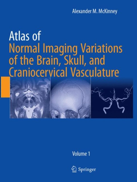 Book cover of: Atlas of Normal Imaging Variations of the Brain, Skull, and Craniocervical Vasculature. By: Alexander M. McKinney