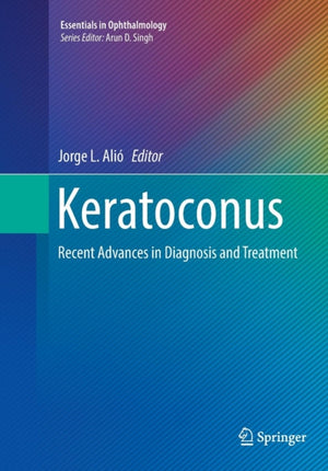 Keratoconus