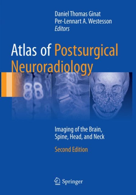 Book cover of: Atlas of Postsurgical Neuroradiology. By: Daniel Thomas Ginat