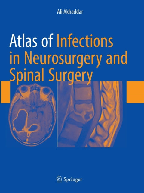 Book cover of: Atlas of Infections in Neurosurgery and Spinal Surgery. By: Ali Akhaddar