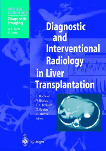 Book cover of: Diagnostic and Interventional Radiology in Liver Transplantation