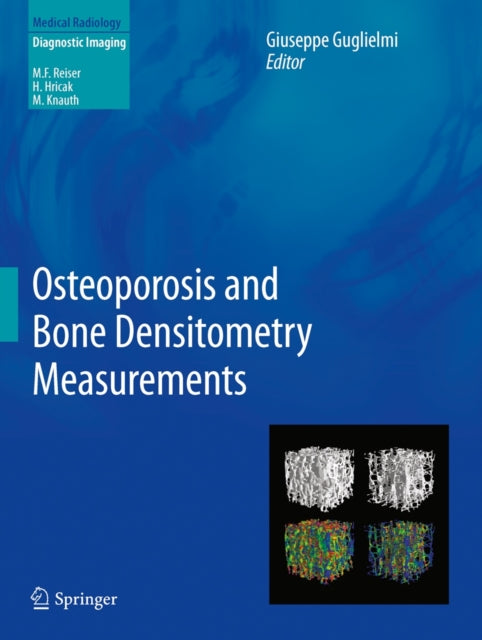 Book cover of: Osteoporosis and Bone Densitometry Measurements